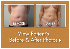 Click here to see before and after pictures of different procedures